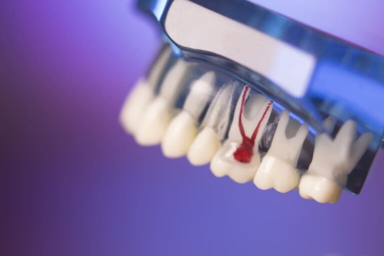 Dental Bone Grafting Antalya