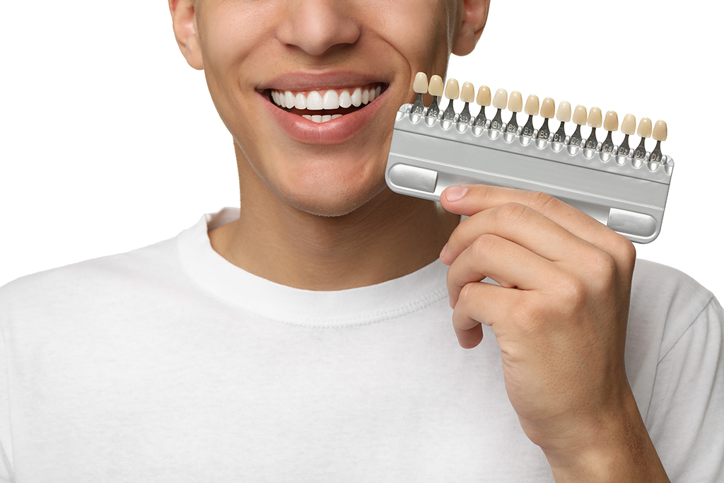 Laminate Veneers in Antalya, Turkey